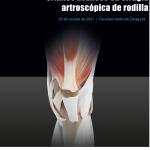 Últimos avances en cirugía artroscópica de Rodilla