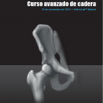 CURSO AVANZADO DE CADERA